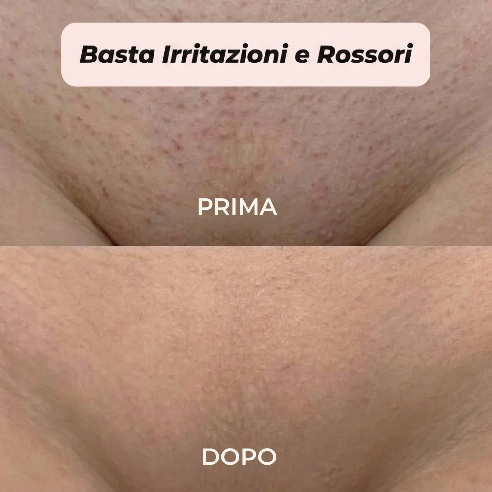 Rasoio 2 in 1 per bikini e corpo