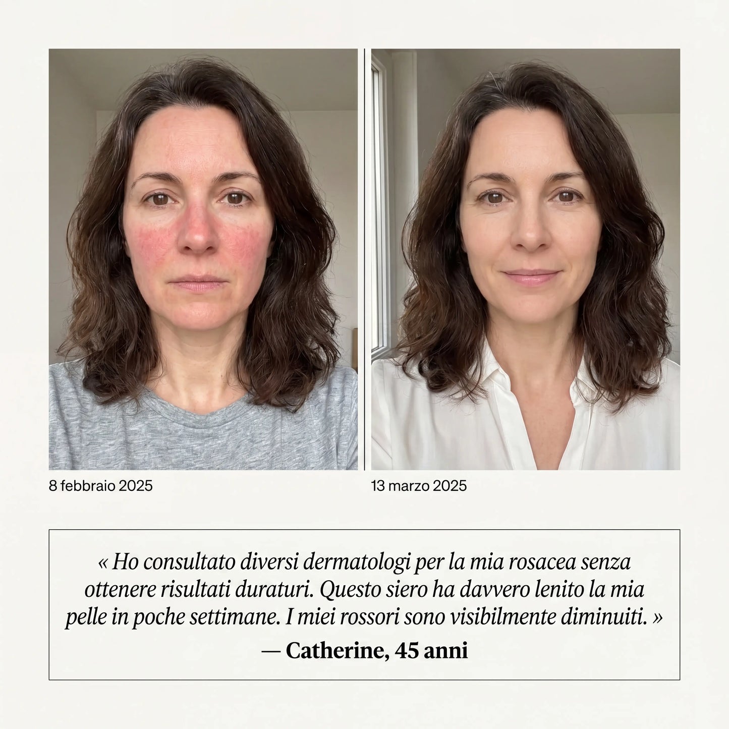 Siero Anti-Rossori