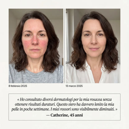 Siero Anti-Rossori