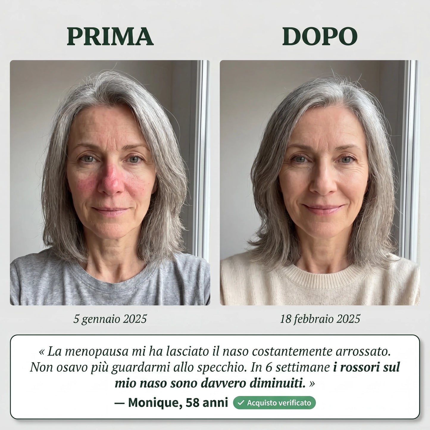 Siero Anti-Rossori
