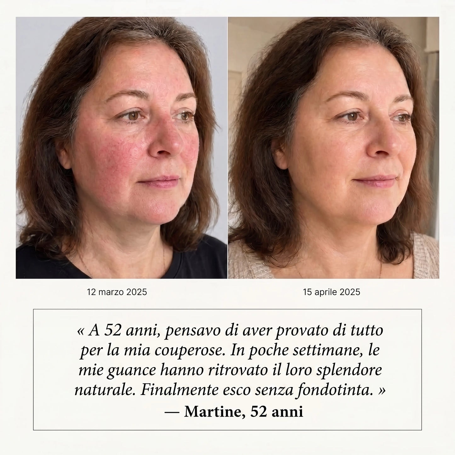 Siero Anti-Rossori