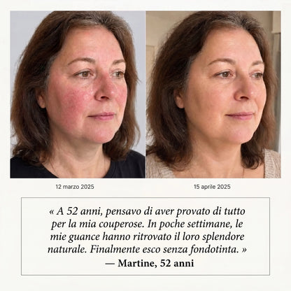 Siero Anti-Rossori