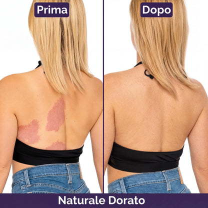 PellePerfetta – Corpo Senza Imperfezioni