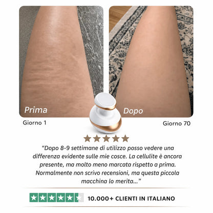 Dispositivo 4-in-1 trattamento cellulite